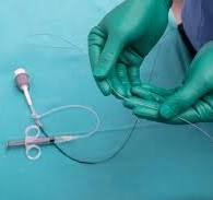 1,6 mil resultados de imágenes, fotos de stock e ilustraciones libres de  regalías para Catheterization lab | Shutterstock