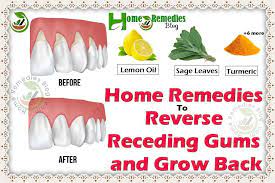 How To Reverse Gum Recession Is The First Thing Pops In Head When You See Bleeding Gums Ever Wondered Reverse Receding Gums Gum Disease Remedies Receding Gums