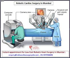 Affordable Robotic Cardiac Surgery Top Surgeons Best Hospitals India Robotic Surgery Surgery Cardiac