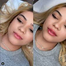 Luna Aesthetics MedSpa, 5249 Duke St, Alexandria, VA 22304, US