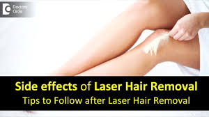 Side effects from laser hair removal include, but are not limited to: Side Effects After Laser Hair Removal Care After Laser Hair Removal Dr Divya Sharma Doctors Circle Youtube