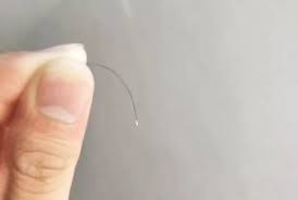 I have lyme disease and developed morgellons disease due to never receiving treatment for lyme. Everything You Need To Know About Hair Follicle
