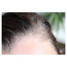 La Coloration Vegetale Et Les Cheveux Blancs Coloration Naturelle Cheveux Coloration Vegetale Cheveux Blancs Cheveux Blancs