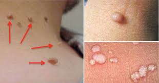 Pin On Health