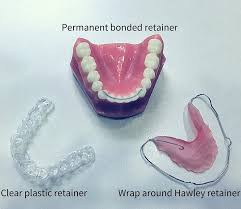 Apr 27, 2021 · how much do permanent retainers cost? Permanent Retainer Fixed Or Bonded Types Costs Pros And Cons