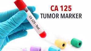 It indicates the presence of breast cancer in the patient who is tested. The Ca 125 Tumor Associated Protein Or Tumor Marker Cancerconnect