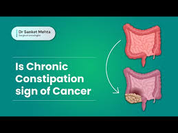 Image result for Constipation in Cancer