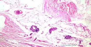 Select from premium human skin of the highest quality. Microscope World Blog Human Nonpigmented Skin Under The Microscope