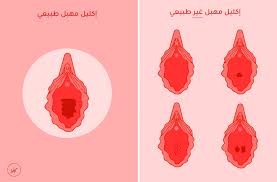 اشكال المهبل الطبيعي , انواع المهبل و شكله - قبلات الحياة