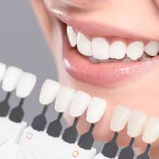 Teeth Whitening - Harvie Dental