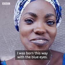 Children laugh saying…'see the eyes of a witch” Risikat says her husband  abandoned her and their children because of the blue colour of their eyes.  This is her story. BBC News Africa