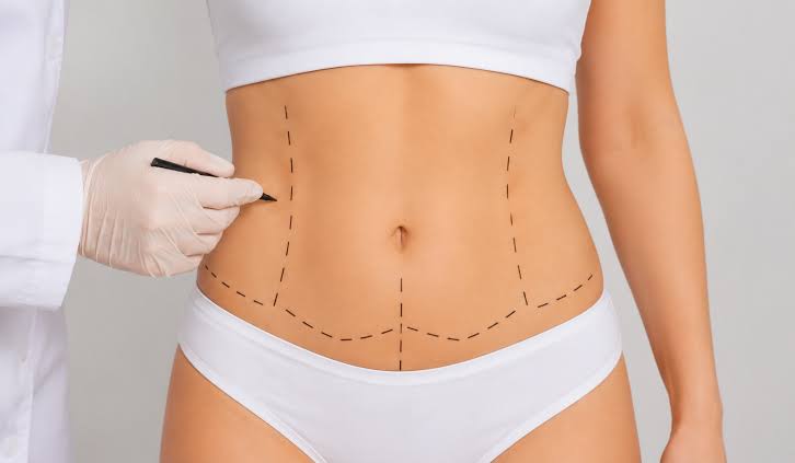 Lipoabdominoplasty in Dubai | Tummy Tuck with Liposuction