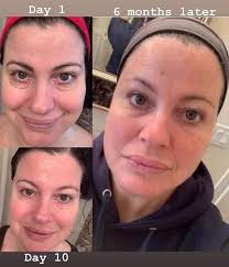 Hi beautiful ladies of Kinsale. If you've been thinking you'd like to use  more natural skincare products, this is your chance to learn about the best  natural ingredients to use