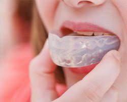 Maybe you would like to learn more about one of these? Custom Athletic Mouthguard Fitchburg Ma Brian C Mcdowell Dds