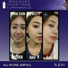 This website is estimated worth of $ 8.95 and have a daily income of around $ 0.15. Trulum Skincare 15ml Instant Glowing Kesehatan Kecantikan Kulit Sabun Tubuh Di Carousell