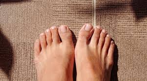 Image result for Yellow nail syndrome feet