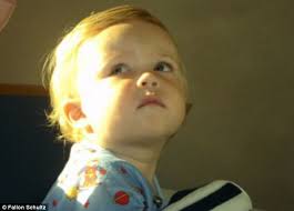 The 6-year-old boy allergic to all foods apart from peanut butter, jelly  and milk