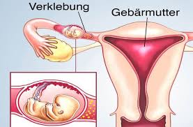 Spätestens dann muss der behandelnde frauenarzt unbedingt eine eingehende untersuchung vornehmen und andere. Nach Eileiterschwangerschaft Ivf Wie Stehen Die Chancen