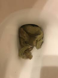 In 2009, who has declared diarrhoea is defined as watery or loose stool usually an increase in normal daily stool volume and. Please Help Me I Am On The Brink Liquid Diarrhea For A Week And Feeling This Is The End Bowel Disorders Forums Patient