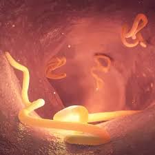 Image result for Pinworm