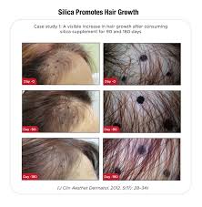 Silica is a trace mineral that may have beneficial effects on your hair condition. Research Proven Benefits Bioactive Organic Silica
