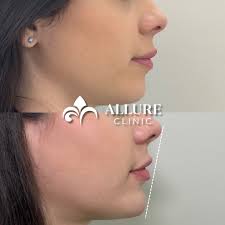 Dr. Alexandra Podvarzachova