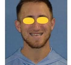 Table Rock Oral Surgery (@tablerockoralsurgery) · Instagram 照片和视频