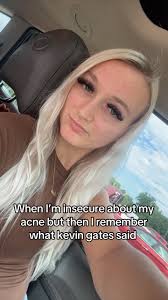 When Im Insecure about My Acne But Remember What Kevin Gates Said