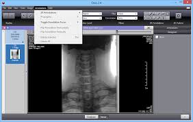 Various tools are available which are arranged in a very clean manner on the interface. 20 Free Open Source Dicom Viewers For Windows