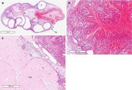 Anatomy Development Histology And Normal Function Of The Ovary Springerlink