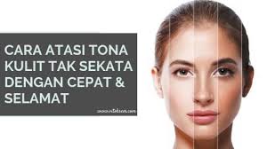 Memutihkan kulit muka ambil sebatang timun batang diparut isi dalam nya dan campur bersama 1/2 biji limau nipis bersama bedak sejuk dipakai di muka tiap tiap malam insyaallah kulit. Cara Atasi Tona Kulit Tak Sekata Dengan Cepat Dan Selamat Nurzalila Razali
