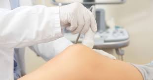 The sodium hyaluronate is only a derivative of hyaluronic acid, it has larger molecules which lack the essential ability to penetrate deep into the skin. Hyaluronic Acid Injections Gel Injections For Knee Pain