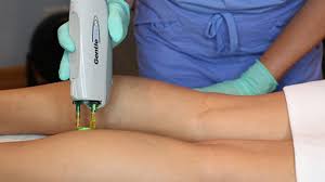  amber is amazing and so informative and let me know exactly what i needed to get my skin looking great  in 21 reviews. Laser Hair Removal Chicago Il Lapiel Laser Center