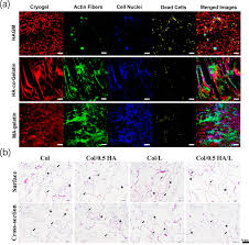 The tables indicate the number of each named bone in the human skeleton, including bones of the human body can be classified (i.e. Hyaluronic Acid As A Bioactive Component For Bone Tissue Regeneration Fabrication Modification Properties And Biological Functions