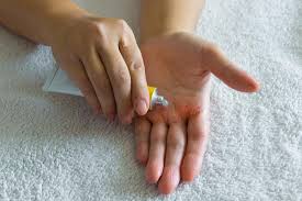Triturations of 'flowers of sulphur' are made with sugar of milk and higher potencies are produced from 3c, a saturated solution of sulphur in absolute alcohol constitutes the. Severe Eczema Treatments For Adults And Children