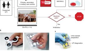 In some advanced cases, cervical cancer causes a buildup of urine in the kidneys. A Fidget Spinner Like Device For Speedy Detection Of Utis In Urine