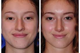 A. Joshua Zimm MD. Facial Plastic & Reconstructive Surgery