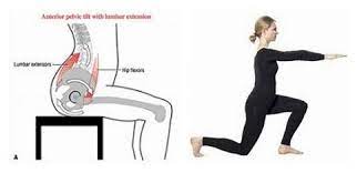 Anterior Pelvic Tilt Correction Guide Right Here Actforlibraries Org