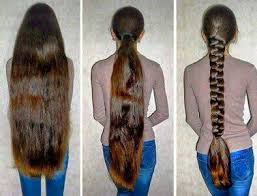 как избавиться от перхоти и выпадения волос в домашних условиях Nedorogie Sredstva Iz Apteki Kotorye Pomogut Zhenshine Stat Krasivoj Zhenskij Mir Lechenie Vypadeniya Volos Recepty Dlya Rosta Volos Sredstva Dlya Rosta Volos