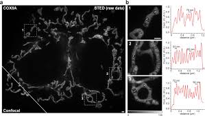 Maybe you would like to learn more about one of these? Live Cell Sted Nanoscopy Of Mitochondrial Cristae Scientific Reports