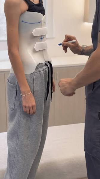 متى يجب مراجعة حزام اعوجاج العمود الفقري بعد التوقف عن ارتدائه؟