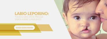 7 famosos que nasceram com malformações e você não sabia