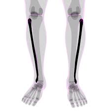 Sign up for free for news on the biggest players and. Expert Explains Tiger Woods Injuries Potential Recovery Process Ahead