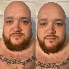 Beard oil before and after results