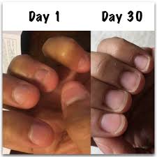 If you don't want to keep your hands busy, then you can keep your mouth busy by chewing mint or a gum. How To Stop Biting Nails Angela S Results Nail Care Hq