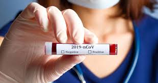 Coronavirus Covid 19 Point Sur Les Tests Federation Francaise Des Diabetiques