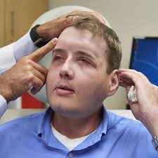 EXCLUSIVE: Mississippi man living like a 'normal dad' one year after  groundbreaking face transplant