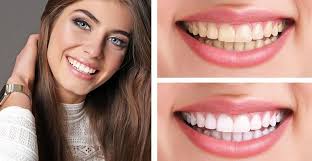 Bator Zai Dental clinic باتورزى ده غاښونو عصري کلینیک