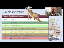 Image result for IDSA Diabetic Foot Wound Classification