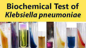 Biochemical Test And Identification Of Klebsiella Pneumoniae